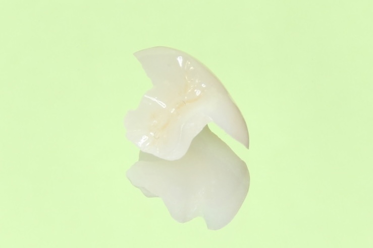 セラミック治療