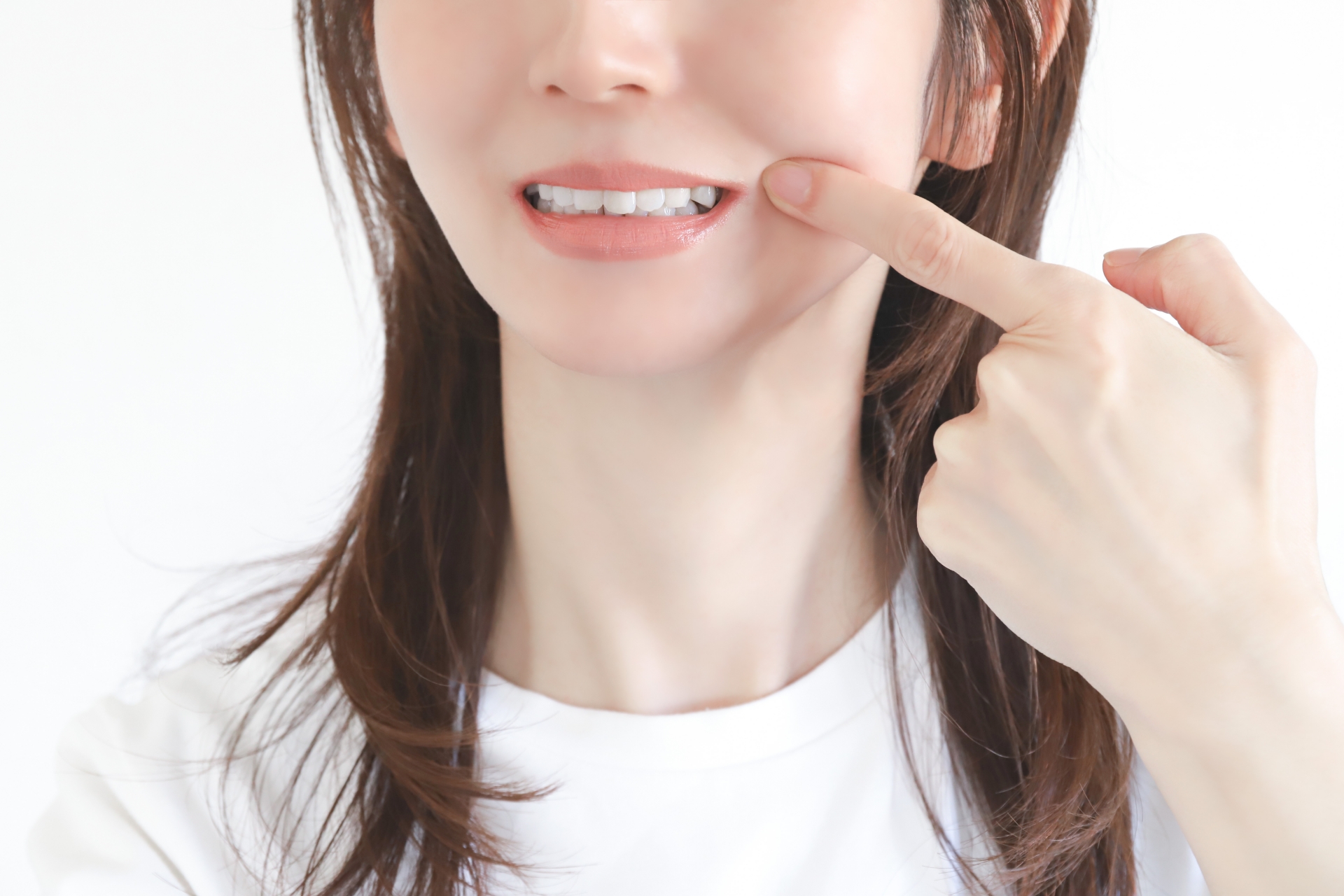 ダイレクトボンディングとは?