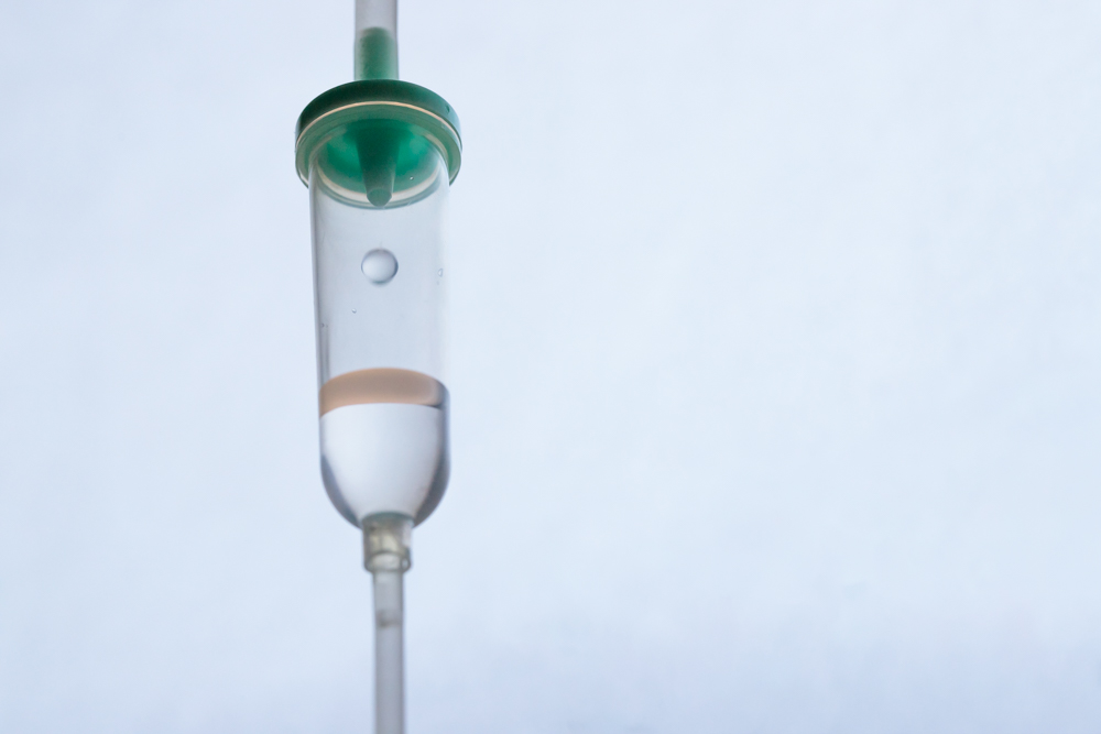 静脈内鎮静法（うたたね治療）